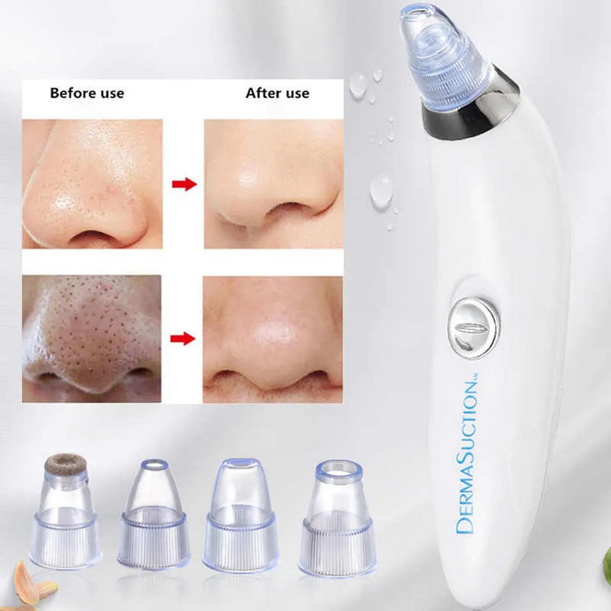 Derma Suction Facial SPA Blackhead Remover Machine 4 in 1 Black Head Remover Machine Acne Pore Cleaner Suction Tool Blackhead Removal Machine