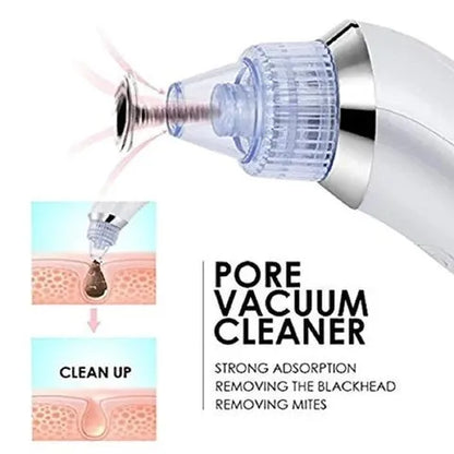 5 in 1 Blackhead remover machine, derma suction, pimple acne remover, blackhead vacuum machine, dust remover, dirt remover, Pimple Popper Tool Pore Vacuum Black Head Remover, Whitehead Acne remover, deep face clean blackhead remover