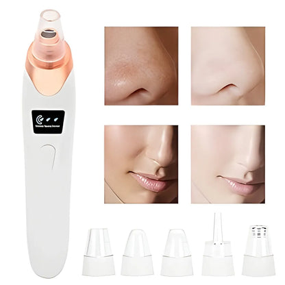 5 in 1 Blackhead remover machine, derma suction, pimple acne remover, blackhead vacuum machine, dust remover, dirt remover, Pimple Popper Tool Pore Vacuum Black Head Remover, Whitehead Acne remover, deep face clean blackhead remover